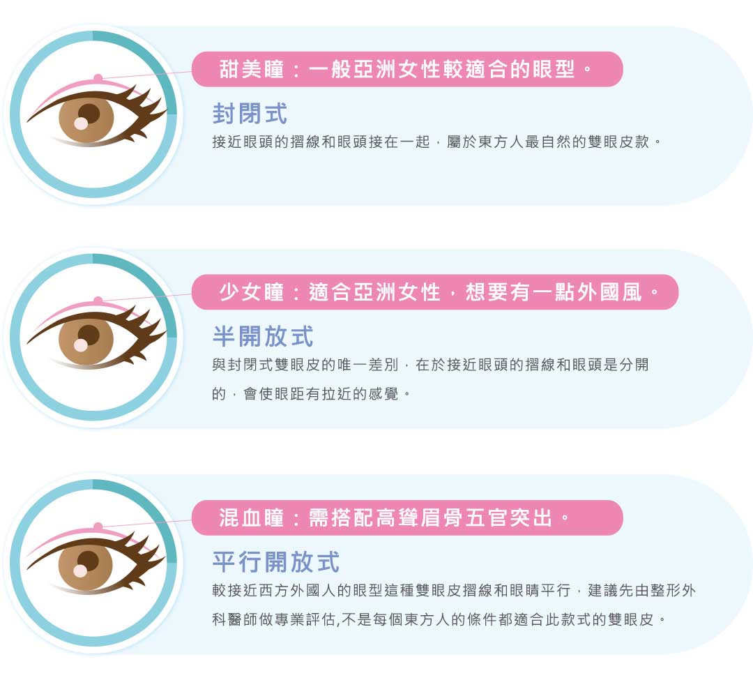 雙眼皮手術款式